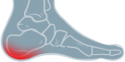 Heel Footmap View